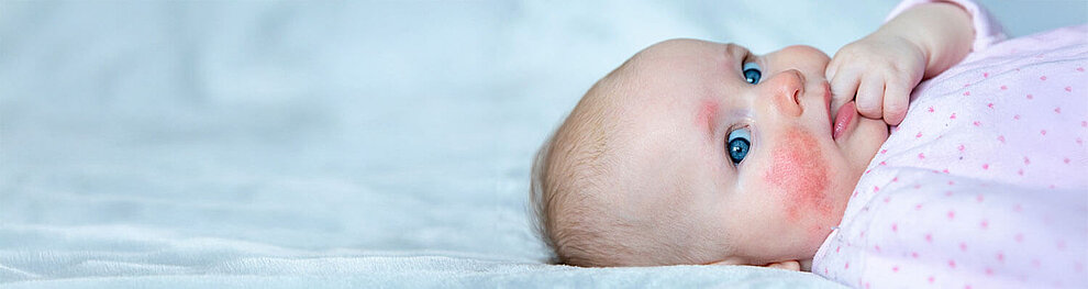 Ein Baby mit blauen Augen, das auf einer weißen Fläche liegt und eine Hand in der Nähe seines Gesichts hat.