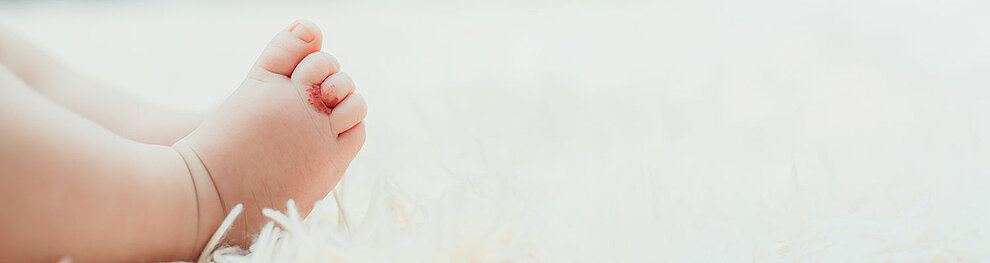 Babyfuß mit einem roten Fleck auf einer weißen, flauschigen Oberfläche.